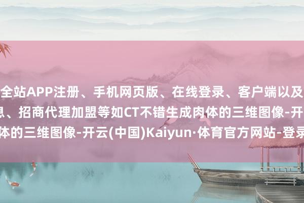 全站APP注册、手机网页版、在线登录、客户端以及发布平台优惠活动信息、招商代理加盟等如CT不错生成肉体的三维图像-开云(中国)Kaiyun·体育官方网站-登录入口
